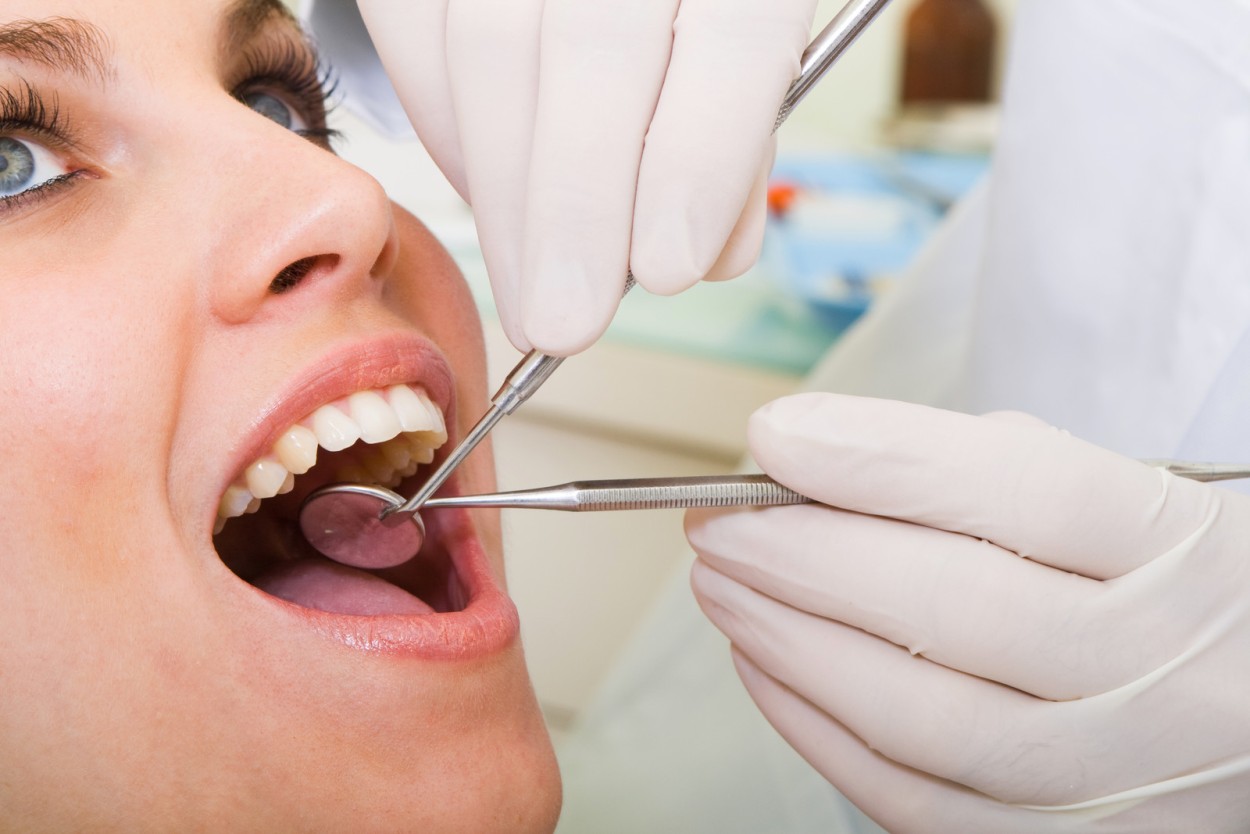 the complete guide to dental cleanings